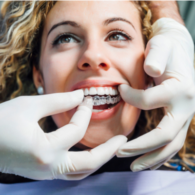 clear-braces-aligners